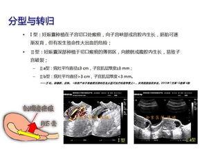 怀孕治疗在线视频,在线视频教程全方位解析